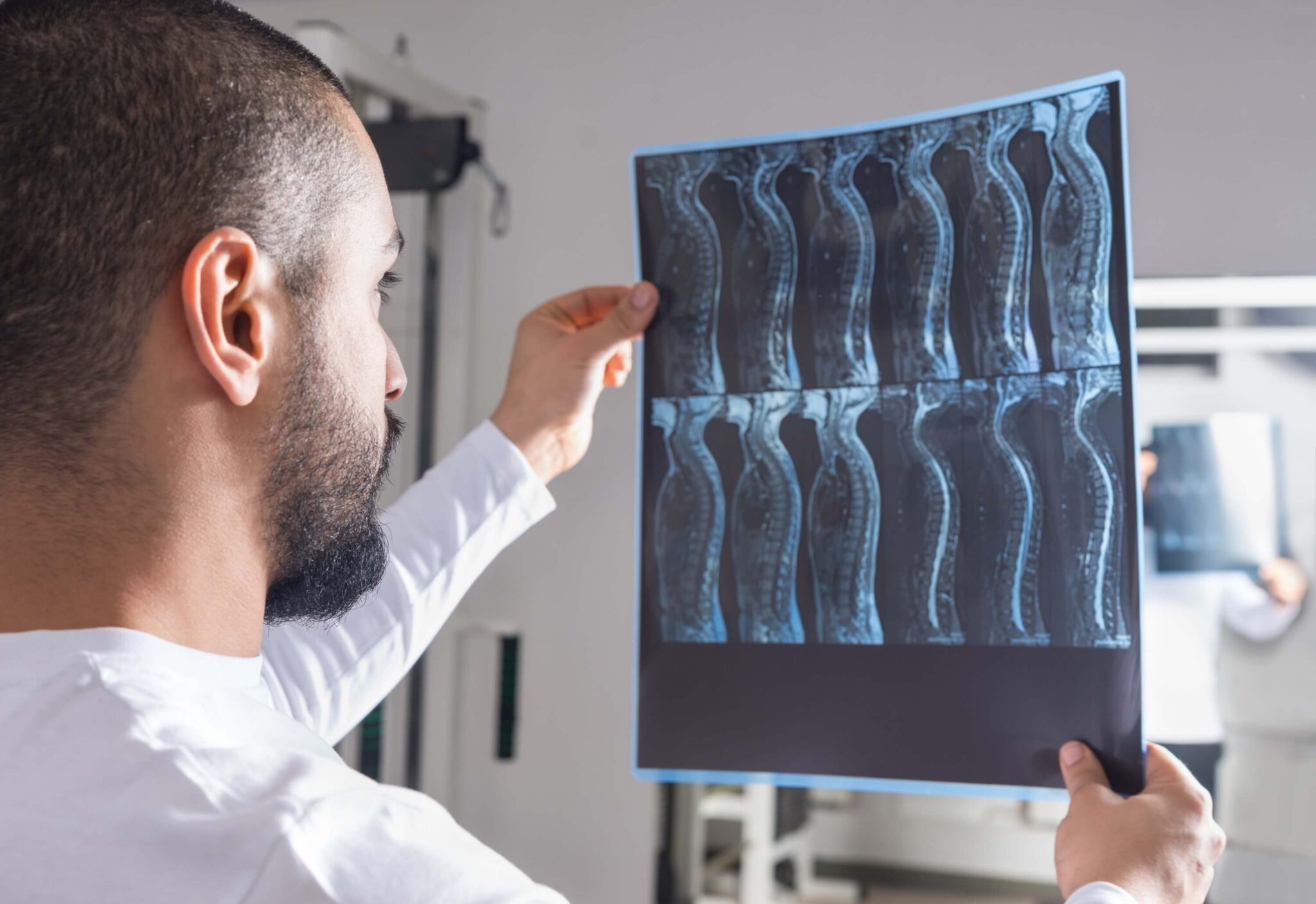 Newest Treatment for Spinal Stenosis | Icon Medical Centers